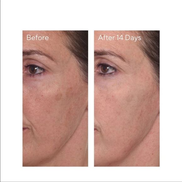 Murad Rapid Dark Spot Correcting Serum - Picture 7 of 12
